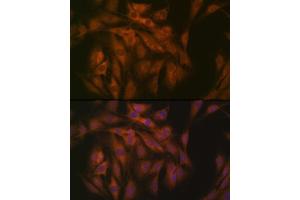 Immunofluorescence analysis of C6 cells using eIF3B Rabbit mAb (ABIN7267042) at dilution of 1:100 (40x lens). (EIF3B 抗体)