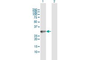 Western Blotting (WB) image for anti-Dynein, Axonemal, Light Intermediate Chain 1 (DNALI1) (AA 1-258) antibody (ABIN521637)