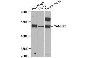 Western blot analysis of extracts of various cell lines, using CAMK2B antibody. (CAMK2B 抗体  (AA 1-300))