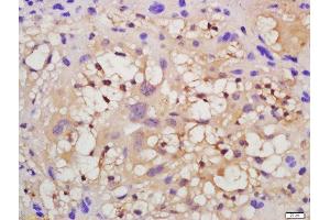 Formalin-fixed and paraffin embedded mouse placenta tissue labeled with Anti-VEGFR2 Polyclonal Antibody, Unconjugated  at 1:200 followed by conjugation to the secondary antibody and DAB staining. (VEGFR2/CD309 抗体  (AA 101-200))