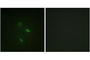 Immunofluorescence analysis of NIH-3T3 cells, using Cyclin E2 (Ab-392) Antibody. (Cyclin E2 抗体  (AA 355-404))