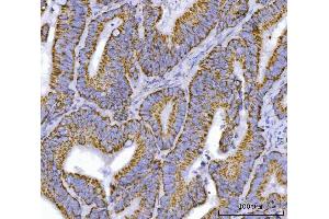 IHC analysis of TFEB using anti-TFEB antibody (ABIN7600648). (TFEB 抗体  (AA 214-326))