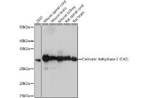 Western blot analysis of extracts of various cell lines, using Carbonic Anhydrase 2 (C) Rabbit mAb (ABIN7266070) at 1:1000 dilution. (CA2 抗体)