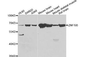 Western blot analysis of extracts of various cell lines, using ZNF195 antibody. (ZNF195 抗体)
