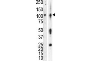 Western Blotting (WB) image for anti-Protein Kinase D3 (PRKD3) antibody (ABIN3002937)