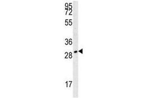 TPSAB1 antibody western blot analysis in 293 lysate. (TPSAB1 抗体  (AA 61-87))