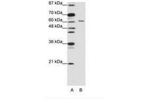 Image no. 2 for anti-CUGBP, Elav-Like Family Member 2 (CELF2) (AA 73-122) antibody (ABIN203186) (CELF2 抗体  (AA 73-122))