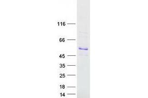 Western Blotting (WB) image for SRY (Sex Determining Region Y)-Box 18 (SOX18) protein (Myc-DYKDDDDK Tag) (ABIN2732448)