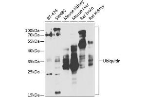Western blot analysis of extracts of various cell lines, using Ubiquitin antibody (ABIN3022990, ABIN3022991, ABIN3022992 and ABIN6219334) at 1:1000 dilution. (Ubiquitin B 抗体  (AA 1-76))