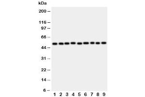 Western blot testing of E2F2 antibody and rat samples 1: lung (E2F2 抗体  (C-Term))