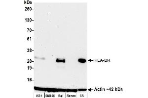 Western Blotting (WB) image for anti-HLA-DR (HLA-DR) antibody (ABIN7449537) (HLA-DR 抗体)