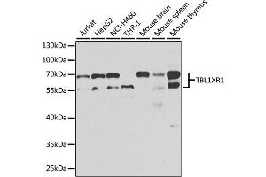 Western blot analysis of extracts of various cell lines, using TBL1XR1 antibody. (TBL1XR1 抗体)