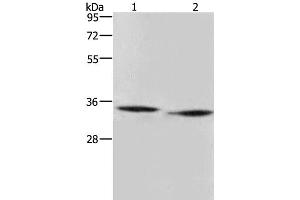 Western Blot analysis of Mouse heart and liver tissue using AMDHD2 Polyclonal Antibody at dilution of 1:500 (AMDHD2 抗体)