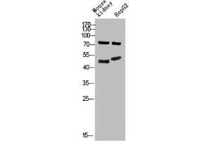 Western Blot analysis of mouse-kidney, hepg2 cells using Antibody diluted at 800. (Thymopoietin 抗体  (AA 1-50))