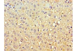 Immunohistochemistry (IHC) image for anti-Carbonyl Reductase 3 (CBR3) (AA 118-277) antibody (ABIN7146745)