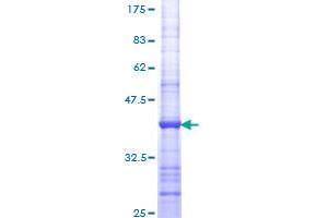 Image no. 1 for Enolase 1 (ENO1) (AA 325-434) protein (GST tag) (ABIN1352801)