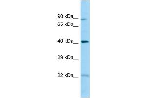 WB Suggested Anti-CHID1 Antibody Titration: 1. (CHID1 抗体  (N-Term))