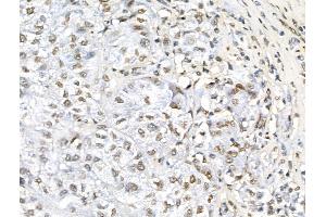 anti-Topoisomerase (DNA) II Binding Protein 1 (TOPBP1) (pSer1138) antibody