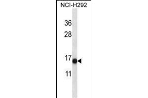 S100A7 Antibody (N-term) (ABIN657716 and ABIN2846704) western blot analysis in NCI- cell line lysates (35 μg/lane). (S100A7 抗体  (N-Term))