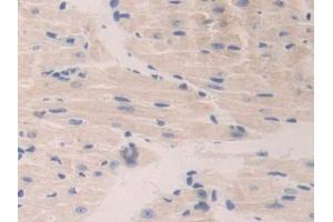 DAB staining on IHC-P; Samples: Mouse Heart Tissue (CTSA 抗体  (AA 215-470))