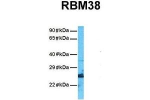 Host:  Rabbit  Target Name:  RBM38  Sample Tissue:  Human A549  Antibody Dilution:  1. (RBM38 抗体  (N-Term))