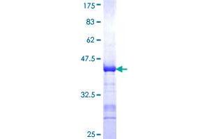 SCG2 Protein (AA 508-617) (GST tag)