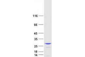 COMMD9 Protein (Transcript Variant 1) (Myc-DYKDDDDK Tag)