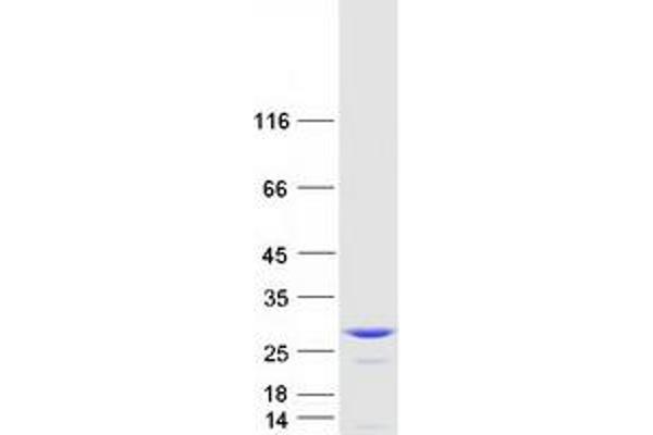 COMMD9 Protein (Transcript Variant 1) (Myc-DYKDDDDK Tag)