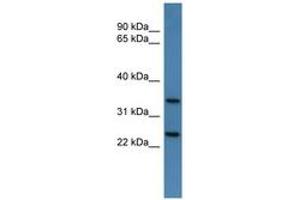 Image no. 1 for anti-Chloride Channel, Nucleotide-Sensitive, 1A (CLNS1A) (AA 138-187) antibody (ABIN6746333)