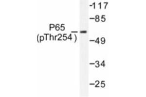 Image no. 1 for anti-Nuclear Factor-kB p65 (NFkBP65) (pThr254) antibody (ABIN318086) (NF-kB p65 抗体  (pThr254))