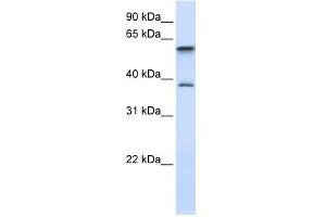 GIMAP5 antibody used at 1 ug/ml to detect target protein. (GIMAP5 抗体  (Middle Region))
