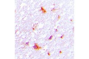 Immunohistochemical analysis of REG4 staining in human brain formalin fixed paraffin embedded tissue section. (REG4 抗体  (Center))