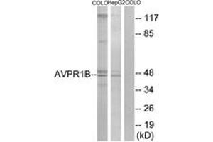 Western blot analysis of extracts from COLO/HepG2 cells, using AVPR1B Antibody. (AVPR1B 抗体  (AA 275-324))