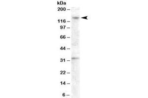 Western blot testing of human ovay lysate with GPR125 antibody at 0. (GPR125 抗体)