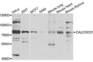 Western blot analysis of extracts of various cells, using CALCOCO1 antibody. (CALCOCO1 抗体)