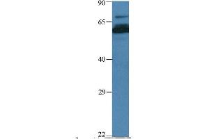 Host:  Rabbit  Target Name:  PHF15  Sample Type:  Human muscle  Antibody Dilution:  1. (PHF15 抗体  (N-Term))