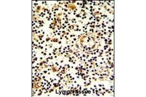 Formalin-fixed and paraffin-embedded human lymph with KLRD1 Antibody (N-term), which was peroxidase-conjugated to the secondary antibody, followed by DAB staining. (CD94 抗体  (N-Term))