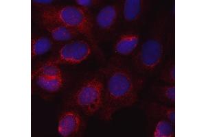 IF analysis of eNOS/NOS3 using anti-eNOS/NOS3 antibody (ABIN7601375). (ENOS 抗体  (AA 34-1153))