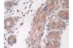 Immunohistochemistry (IHC) image for anti-DEAD (Asp-Glu-Ala-Asp) Box Polypeptide 58 (DDX58) (AA 1-211) antibody (ABIN7440305)