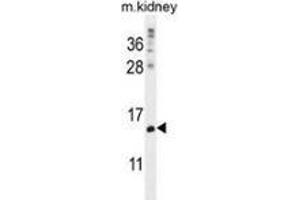 Western blot analysis in mouse kidney tissue lysates (35ug/lane) using MORN5 Antibody (C-term). (MORN5 抗体  (C-Term))