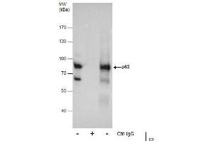IP Image Immunoprecipitation of p63 protein from A431 whole cell extracts using 5 μg of p63 antibody [N2C1], Internal, Western blot analysis was performed using p63 antibody [N2C1], Internal, EasyBlot anti-Rabbit IgG  was used as a secondary reagent. (p63 抗体)