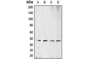 Western blot analysis of BCKDK expression in Raji (A), HeLa (B), Jurkat (C), SHSY5Y (D) whole cell lysates. (BCKDK 抗体  (N-Term))