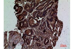 Immunohistochemistry (IHC) analysis of paraffin-embedded Human Prostate Cancer, antibody was diluted at 1:100. (CD300LG 抗体  (Internal Region))