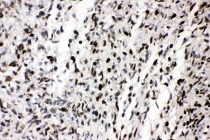 IHC analysis of ZEB1 using anti-ZEB1 antibody (ABIN7602984). (ZEB1 抗体  (Middle Region))