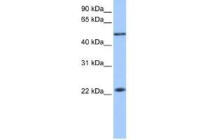 WB Suggested Anti-PIAS2 Antibody Titration: 0. (PIAS2 抗体  (N-Term))
