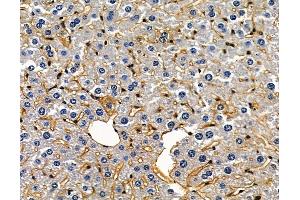 anti-SI antibody