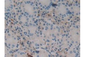 Immunohistochemistry (IHC) image for anti-Calbindin 2 (CALB2) (AA 28-248) antibody (ABIN7432391)