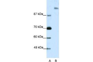 WB Suggested Anti-SUPT6H Antibody Titration:  2. (Spt6 抗体  (N-Term))