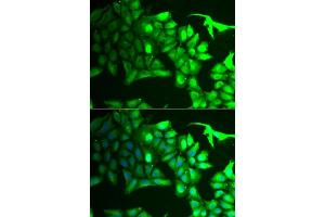 Immunofluorescence analysis of HeLa cells using  antibody (ABIN6129964, ABIN6136691, ABIN6136693 and ABIN6222112).