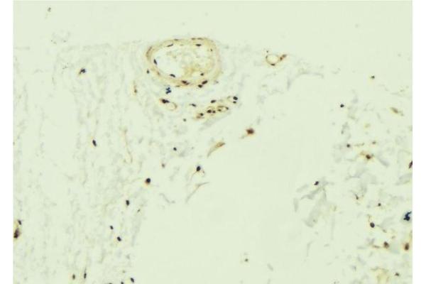 ZNF592 抗体  (Internal Region)
